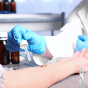 Doctor making allergy test in laboratory