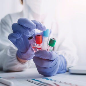 doctor hand taking a blood sample tube from a rack with machines