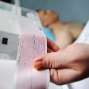Nurse makes the patient cardiogram