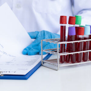 Scientists or physicians analyze the blood sample in vitro to pr