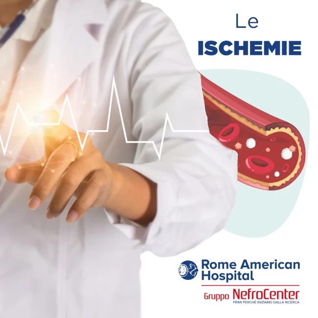 ischemie